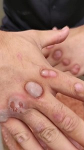 I will break the bricks with the palm of my hand. 🧱🧱👊🏻👊🏻 Chinese Kung Fu Do not try to do at home. #chinesekungfu #kungfu #Reel #martialarts #chinesemartialarts #kungfumaster #shaolinkungfu #wingchun #shaolin #kickboxing #boxing #taichi #kungfutraining #kungfumovies #taekwondo #brucelee #martialartsmovies #kidsmuaythai #kidswushu #gongfu #muayhai #qysmma #kungfulife #qyswushu #kidsmma #kidsbjj #grappling #bjj | Martial Arts