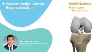 Posteromedial Corner Recontruction