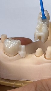 143K views · 3.1K reactions | Metal free Attachments! | CEO Luke Kahng | Facebook