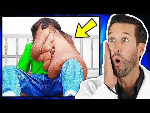 ER Doctor REACTS to World's Rarest Diseases