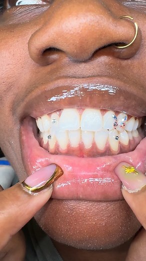 Butterfly Effect 3 Round Gems 🦋💎 ✨ Ready to Learn a New Skill? ✨ Want to get certified in Tooth Gems, Teeth Whitening, or Permanent Jewelry? 💎🔥 Click the link in my bio for details on upcoming training courses and start building your career today! #TheToothJeweler #ATLToothFairy #ATLToothGems #ToothGemsAtlanta #AtlantaToothGems #AtlantaTeethWhitening #AtlantaPermanentJewelry #PermanentJewelryATL #NeedlelessLipFillerATL #ATLEntrepreneur #AtlantaEsthetician #AtlantaSalonSuites #ATLBoothRentals