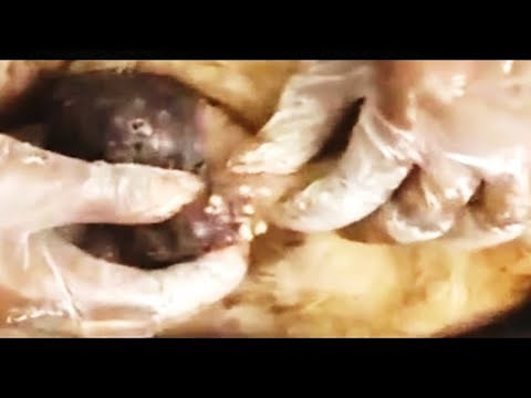 Most Satisfying Mangoworm Removal! Dog Rescue Videos #4 // #mangoworms #botflyremoval