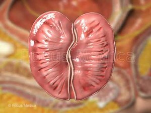 Risk factors for BPH - Animated Atlas of BPH and OAB