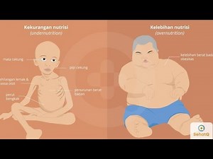 Malnutrisi Energi Protein (Marasmus/Kwarshiorkor) bersama dr. Ulwan