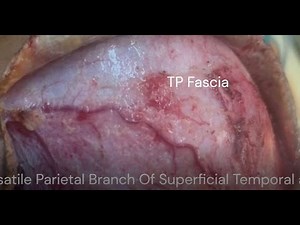 Temporoparietal Fascia & Superficial Temporal Artery