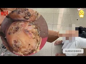 🛑 Extreme Jigger Build-Up – Thick Plates of Skin Detached! #DK322