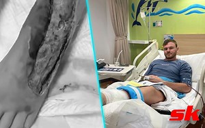 Tim Schultz, fighter at life risk for leg infection, undergoes surgery - Here's the latest update