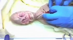 Top Secret KGB Files - Alien Autopsy in Russia 1969