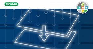 Western Blotting Transfer Techniques
