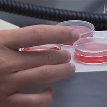 Video: The Analysis of Purkinje Cell Dendritic Morphology in Organotypic Slice Cultures