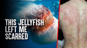 The Top 10 Most Venomous Jellyfish and How to Survive Their Encounter