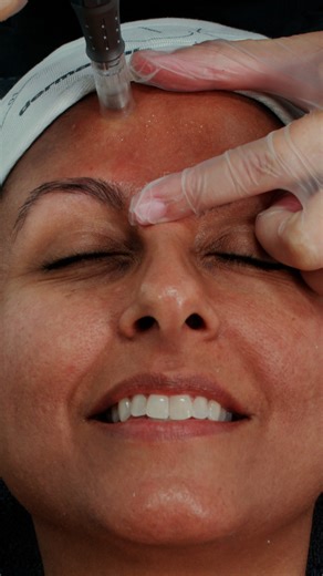 Calling all esthetics professionals! The registration date for the Dermalogica NanoInfusion Pro Pen Certification is now Monday, June 19th - that gives you one additional week to reserve your spot! Don't miss out on the opportunity to add this in-demand and extremely profitable service to your menu. 💵✨ Limited spots available - register today: ericfisheracademy.com/events/dermalogica-pro-pen-certification | Eric Fisher Academy