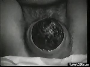 Perfect Baby Crowning on Make a GIF