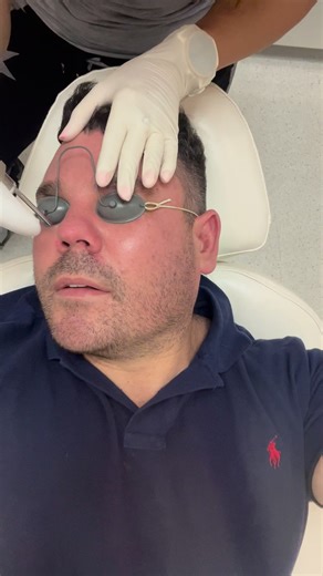 Small blood vessel laser treatment | Newcastle Cosmetic Doctor