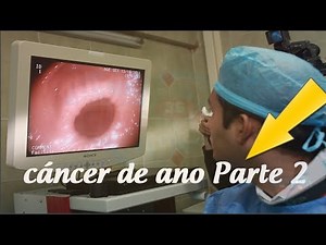 síntomas del cáncer de ano, la enfermedad silenciosa que debes conocer Parte 2