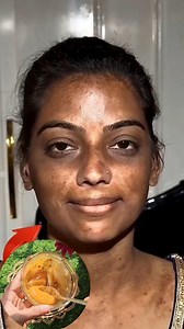 1.6M views · 7.2K reactions | Clean Dark Spots & Pigmentation Naturally At Home | Get Glowing Skin | Remove Tanning . . . #darkspots #pigmentation #darkspotscleaning #GlowingSkin #reelsvideoシ #fbreelsfypシ゚ #reelsviralシ #fblifestyles #reelschallenge #facebookpostシ | Natural Beauty Remedy | Facebook
