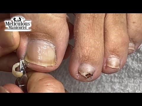 Mr. Meticulous Deep Sidewall Cleaning Ingrown Prevention