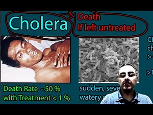 Cholera - Severe Watery Diarrhea which with 50% death rate