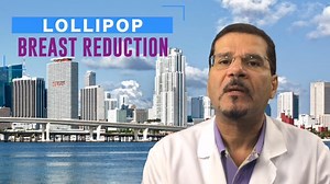 Lollipop Breast Reduction