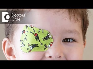 How many hours per day patching is enough when treating Amblyopia? - Dr. Sirish Nelivigi