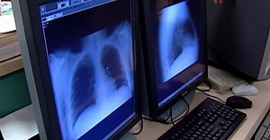 Arizona Medicaid recipients asked to update contact info