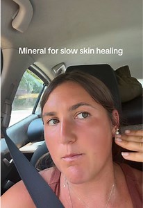 Zinc for Slow Skin Healing: Food-First Tips for Acne Scars