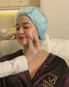 20K views · 257 reactions | Have you experienced the #BeloThermage magic yet ? More are getting captivated including our androgynous #BeloBaby , @sueannadoodles ! ••• We did half her face first and the results are amazing . Check it out ♥️ ••• FOR QUESTIONS AND QUERIES , please follow and send a message to @belobeauty or reach us through : info@belomed.com ☎️819-2356 | Vicki Belo, M.D. | Facebook