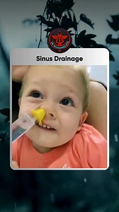 15K views · 54 reactions | Sinus Drainage . www.drmuhammedziya.com ....