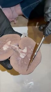 Sheep Kidney Dissection