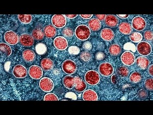 WHO declares deadly new mpox strain a global public health emergency