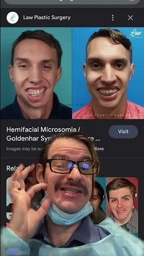 What is Goldenhar Syndrome?