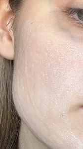 Your Summer Skin Refresh 🌟 Discover radiant results with a FREE facial ice roller with every clinically proven, gel-to-foam Detoxifying Oxygen Mask purchase! ⚡ Clinically proven to boost hydration for 72 hours!* This fruit-derived AHA and kaolin clay exfoliator purifies and revitalizes for an instant dewy glow. *Ends August 7. Must be logged into your Kiss & Tell account to qualify for gift with purchase. While supplies last. Clinical grading results are measured by expert observation and analy