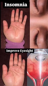 Mudra For Insomnia & Vision Improve🌻 Practice 15-20min Daily🧘‍♀️ Follow ~ @shivangiyogastudio Follow ~ @shivangiyogastudio #yoga #mudra #insomnia #eyesight #viral #yogateacher #instadaily #love #instagood #insta #instagram #follow #followforfollowback #yogini #yogalove #beyou #fyp #health #fitness | yoga_withshivi