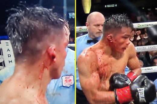 Ringside footage shows shocking moment boxer’s ear ‘EXPLODES’ in horror injury during fight with blood splattered all over camera