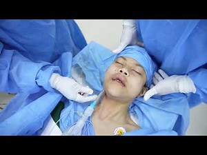 Girl Waking Up From General Anesthesia After Surgery