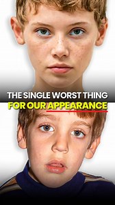 Fix Mouth Breathing for Better Health & Looks