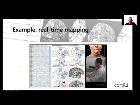 Real-time Functional Mapping Using High-Gamma and Ultra High-Gamma Activity