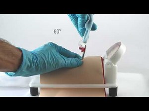 Quicktrach I Punktionskoniotomie - Anwendung