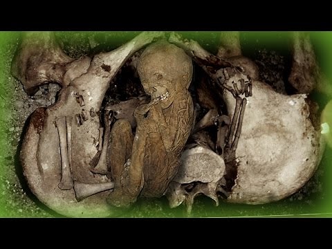 The Morbid Reality Of Coffin Births