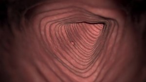 3d Rendered Animation Colon Cancer Sigmoid Stock Footage Video (100% Royalty-free) 1097105603 | Shutterstock