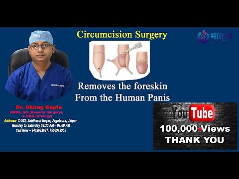 Circumcision Surgery Benefits | Circumcision Procedure Step By Step