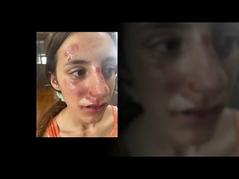 Girl, 13, says she was bullied, beaten at school in Gardner, Illinois | ABC7 Chicago