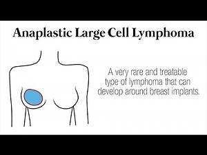 Do Textured Implants Cause ALCL Cases
