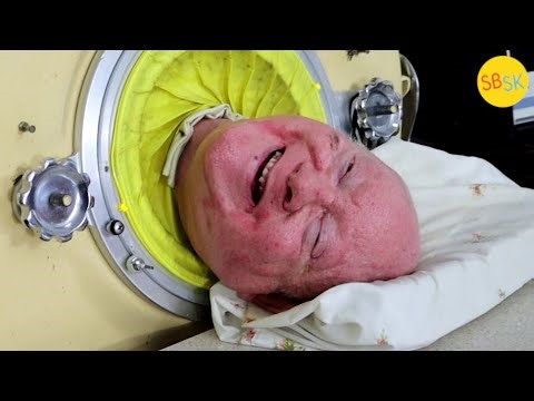 Paul Alexander, forced into an iron lung by polio in 1952, dies at 78