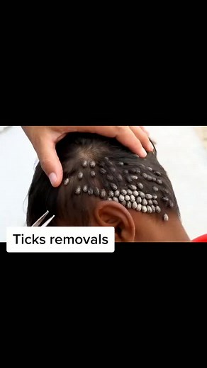 Bot Fly Removal: Tips and Techniques for Ticks Removal