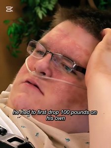 171K views · 886 reactions | Voici les conséquences d'une mauvaise alimentation due à des problèmes émotionnels.#santé #alimentation | Shymes france | Facebook