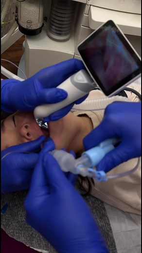 Pediatric Intubation with Video Laryngoscope for Dental Treatment