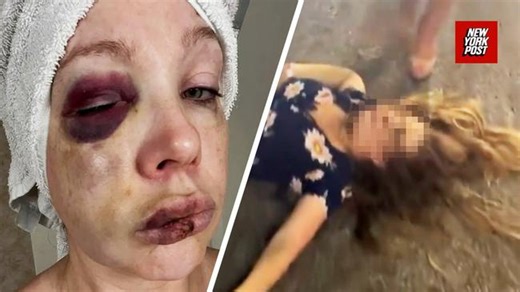 Woman beaten in Cincinnati brawl goes home to Russia – as attacker’s family says people only care because she’s white