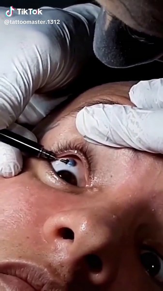 EYEBALL TATTOO #tattoo #fypp #tattooartist #fyp #tatuaje #blackouttattoo #eyes #eyeballtattoo #fy