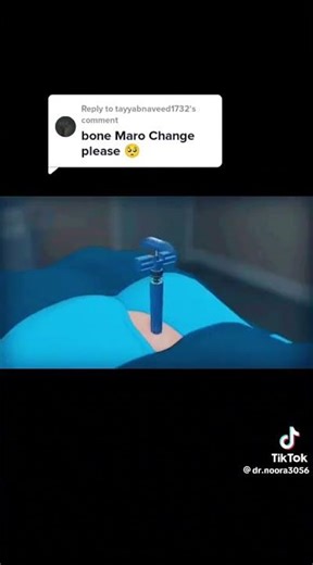 How bone marrow transplant works